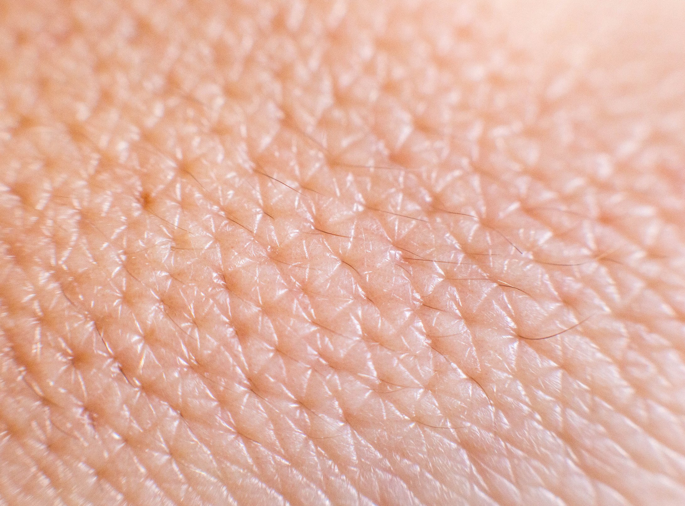 Closeup of porous oily human skin. Large pores on the skin, background, macro, cosmetology